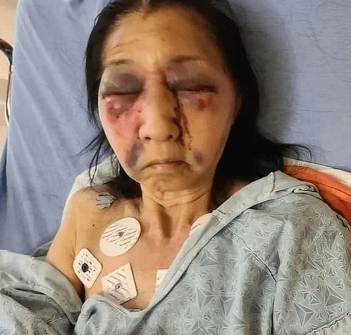 WTF?! Joven racista golpea a abuelita de ascendencia mexicana en EU