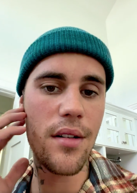 Justin Bieber explica que tiene el síndrome de Ramsay Hunt