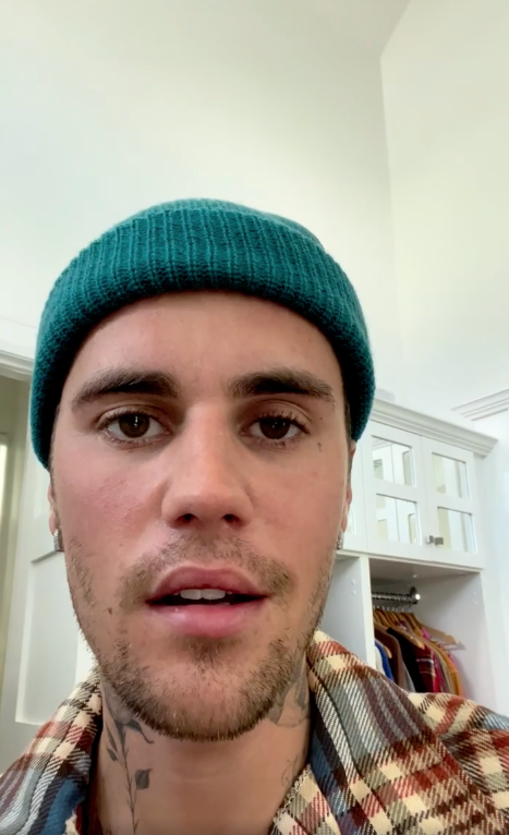 Justin Bieber explica que tiene el síndrome de Ramsay Hunt