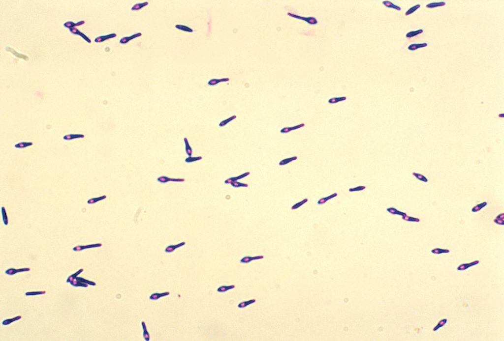 La bacteria del botulismo