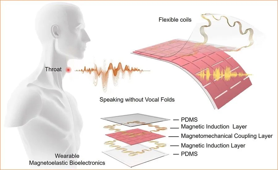 dispositivo parche hablar cuerdas vocales