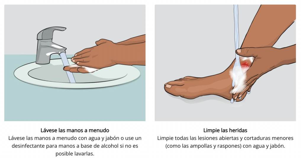 Las medidas que hay que tomar para evitar una infección por estreptococo A.